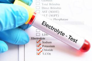 Electrolyte Panel Test at Home in Qatar – Convenient Testing for Essential Minerals and Hydration Levels