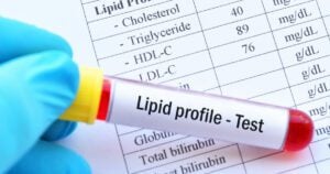 Lipid and Cholesterol Profile Test at Home in Qatar – Clear Diamond Nursing