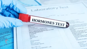 Male Hormone Profile Test at Home in Qatar – Convenient Testosterone and Hormone Level Analysis