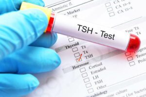 Thyroid Profile Testing for Accurate Hormone Analysis at Home