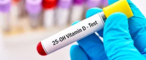 Vitamin D Profile Test at Home in Qatar – Accurate Vitamin D Level Analysis for Bone and Immune Health