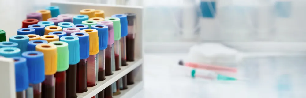 Color-coded blood sample collection tubes arranged in a laboratory rack with a syringe in the background.